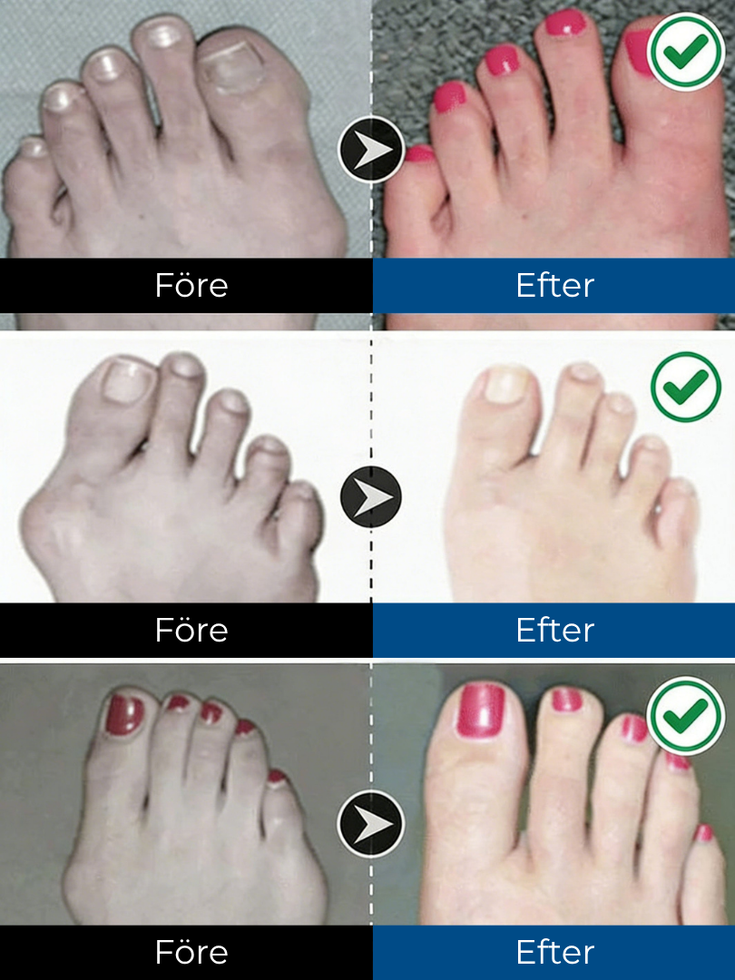 ComfortStep Ortho™ | Säg hejdå till trötta, trånga fötter – och hej till naturlig komfort i varje steg!