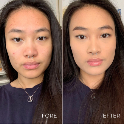 LumaLift™ Concealer | Få Piggare Ögon På Sekunder – Upptäck LumaLift™ Concealer För En Strålande, Fräsch Look!
