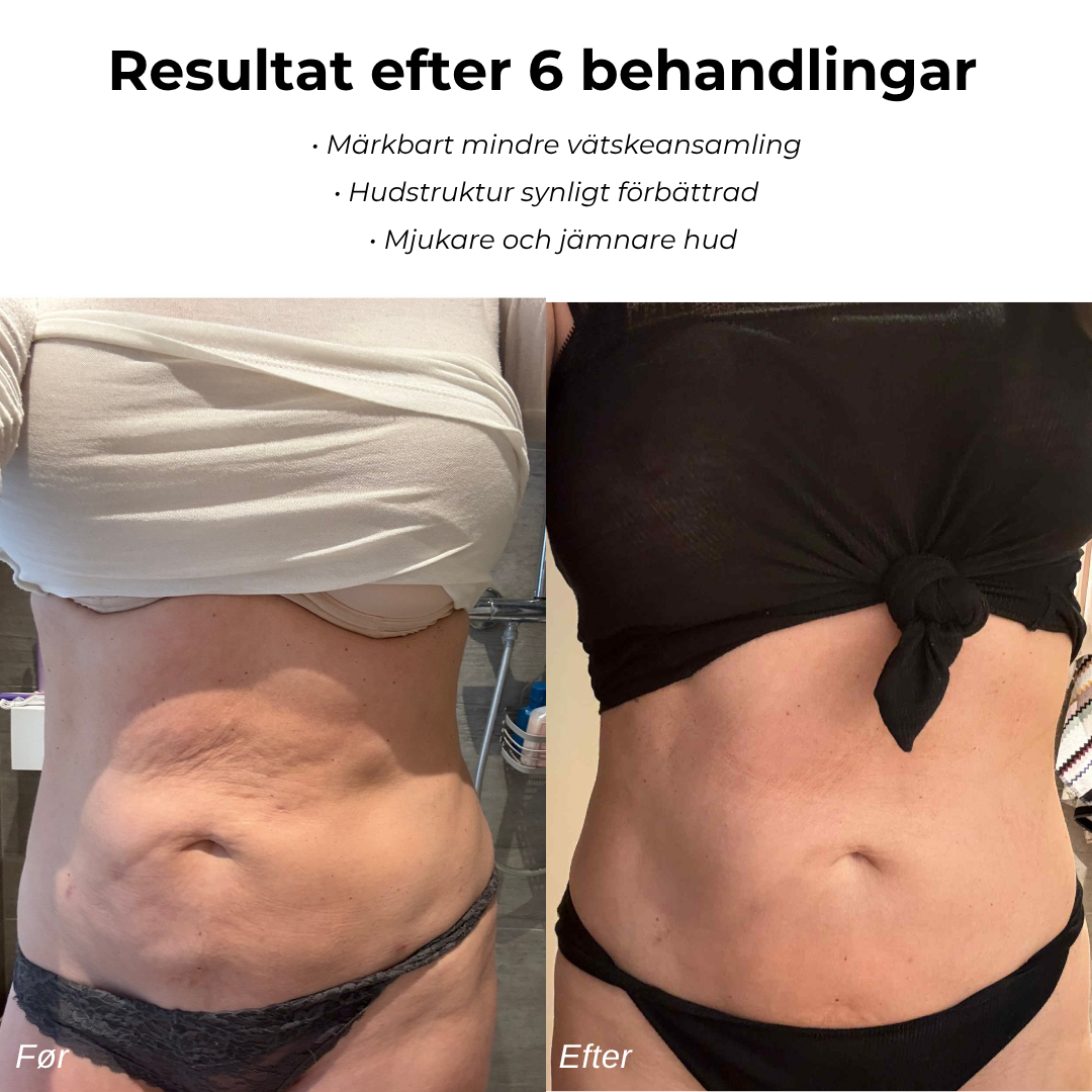 SmoothWave™ – Djupgående massage & värme för mjukare hud