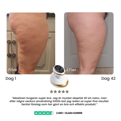 SmoothWave™ – Djupgående massage & värme för mjukare hud